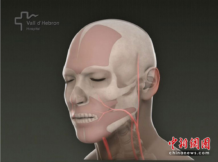 世界首例完整面部移植手术成功